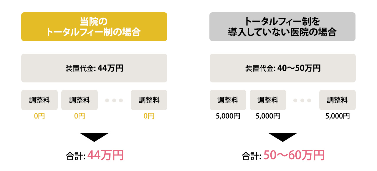 安心のトータルフィー制度